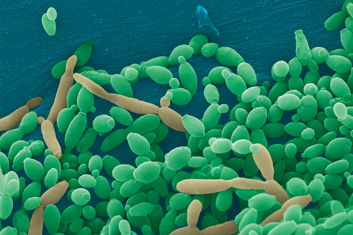 Молочница бактерии. Candida tropicalis микробиология. Грибы микроорганизмы кандиды. Дрожжеподобный грибок кандида.